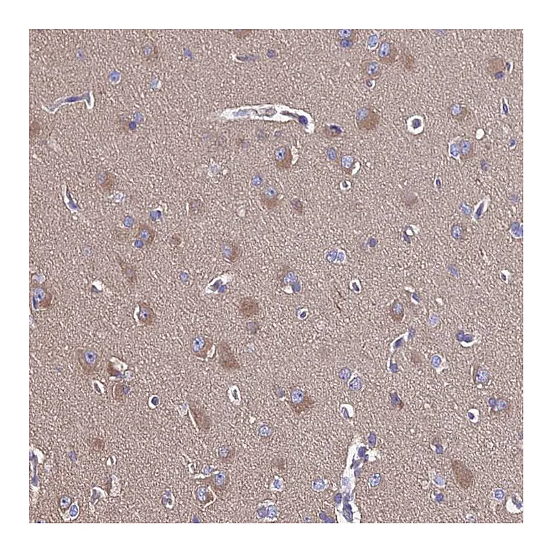 Atlas Antibodies Anti-CALM1 Antibody