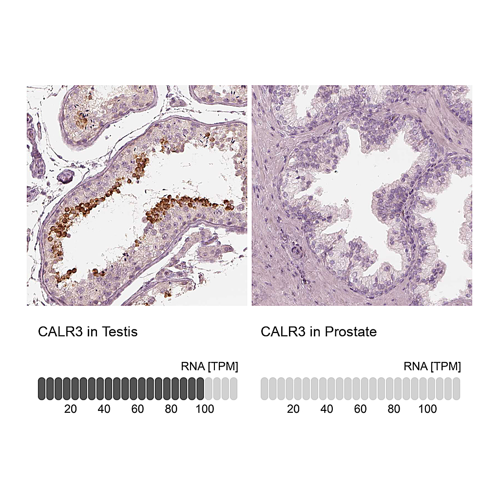 Atlas Antibodies Anti-CALR3 Antibody