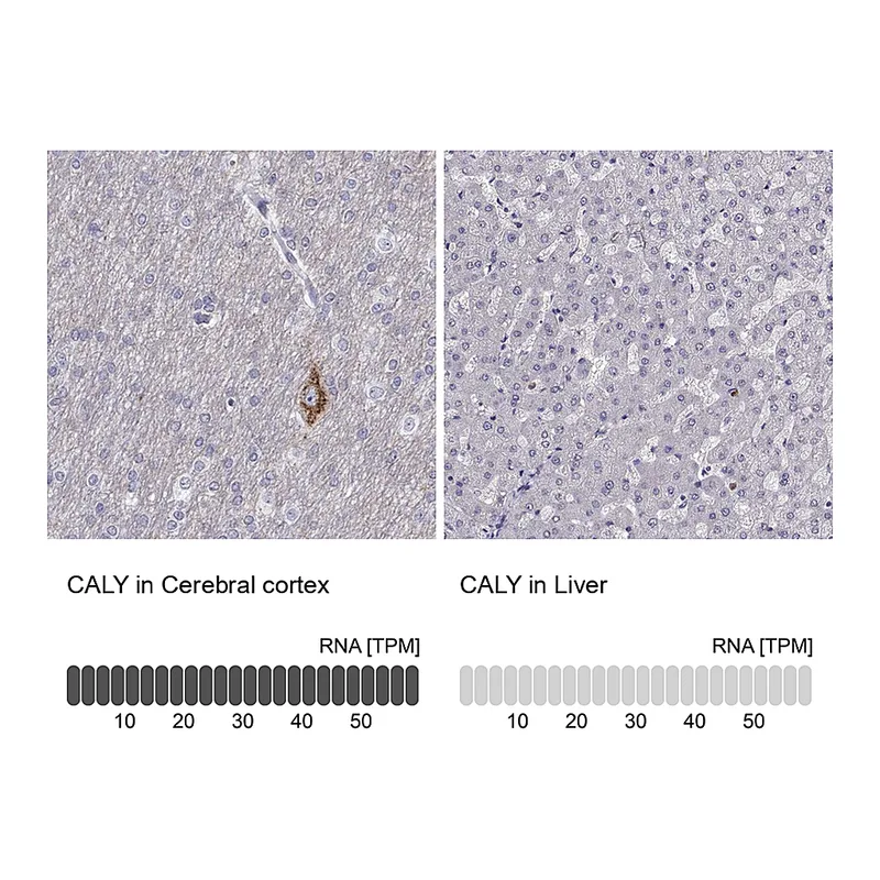 Atlas Antibodies Anti-CALY Antibody