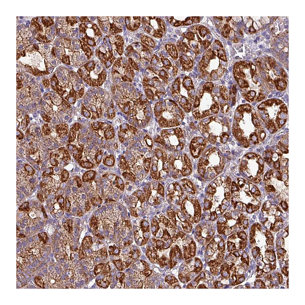 Atlas Antibodies Anti-CAMK1 Antibody