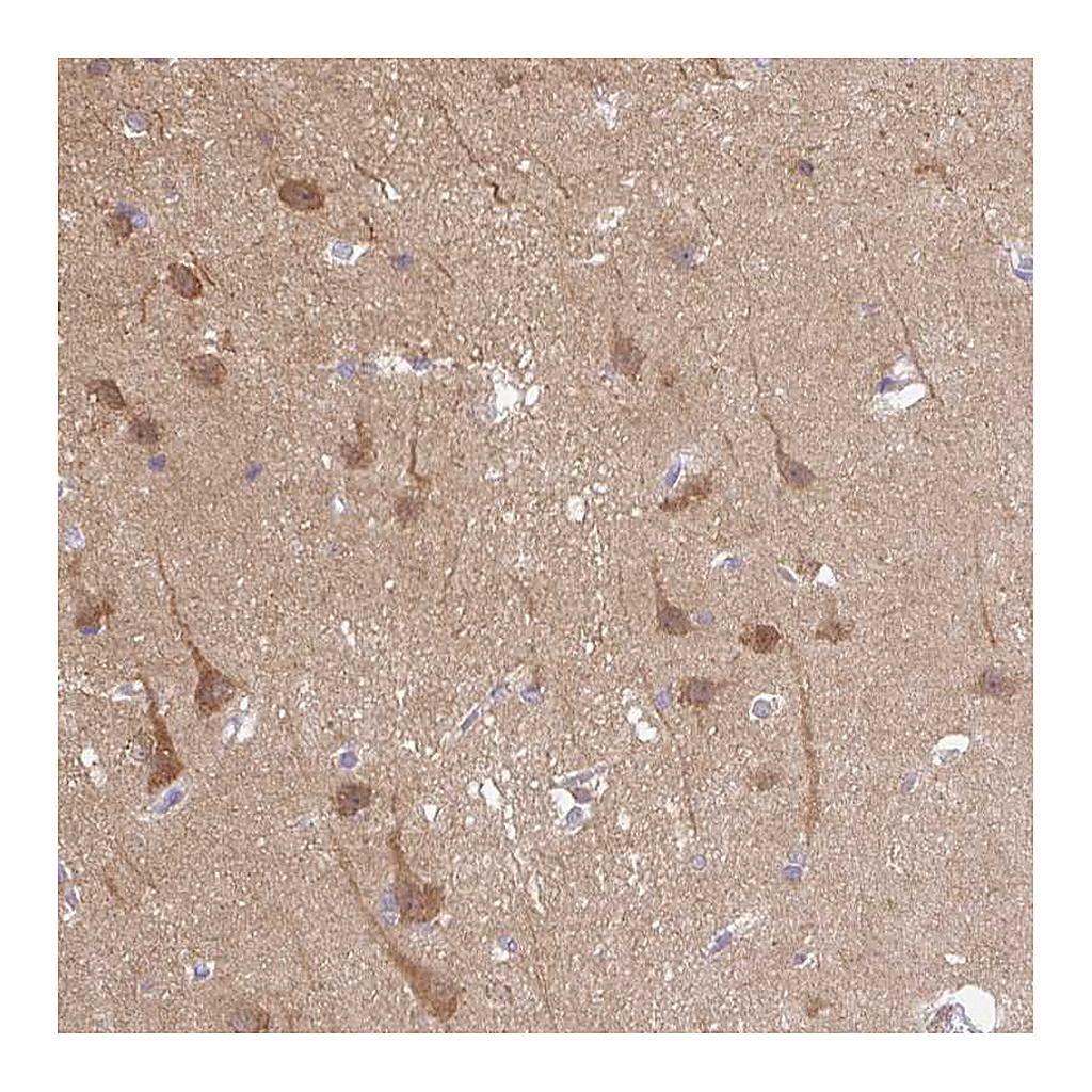 Atlas Antibodies Anti-CAMK2A Antibody