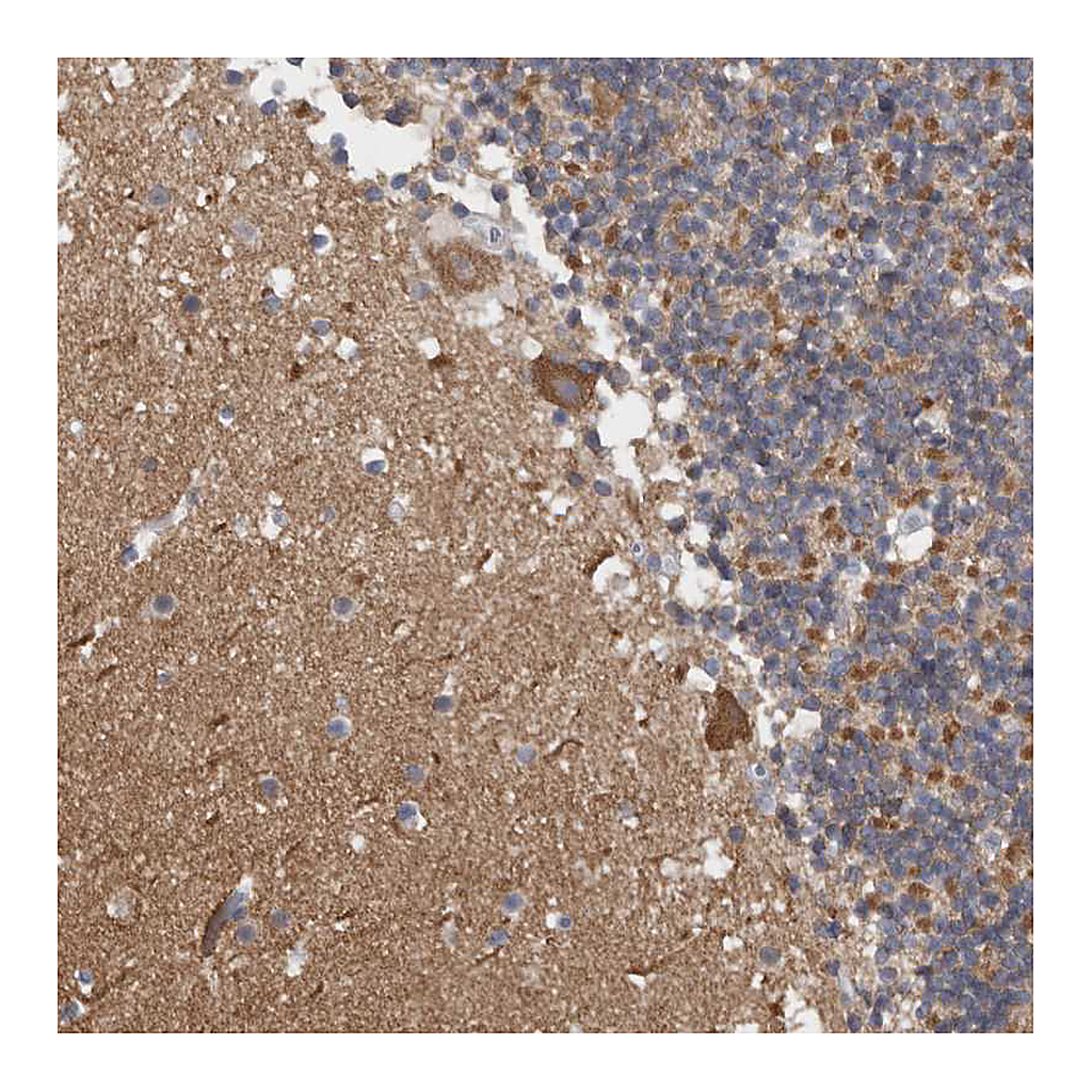 Atlas Antibodies Anti-CAMK2D Antibody