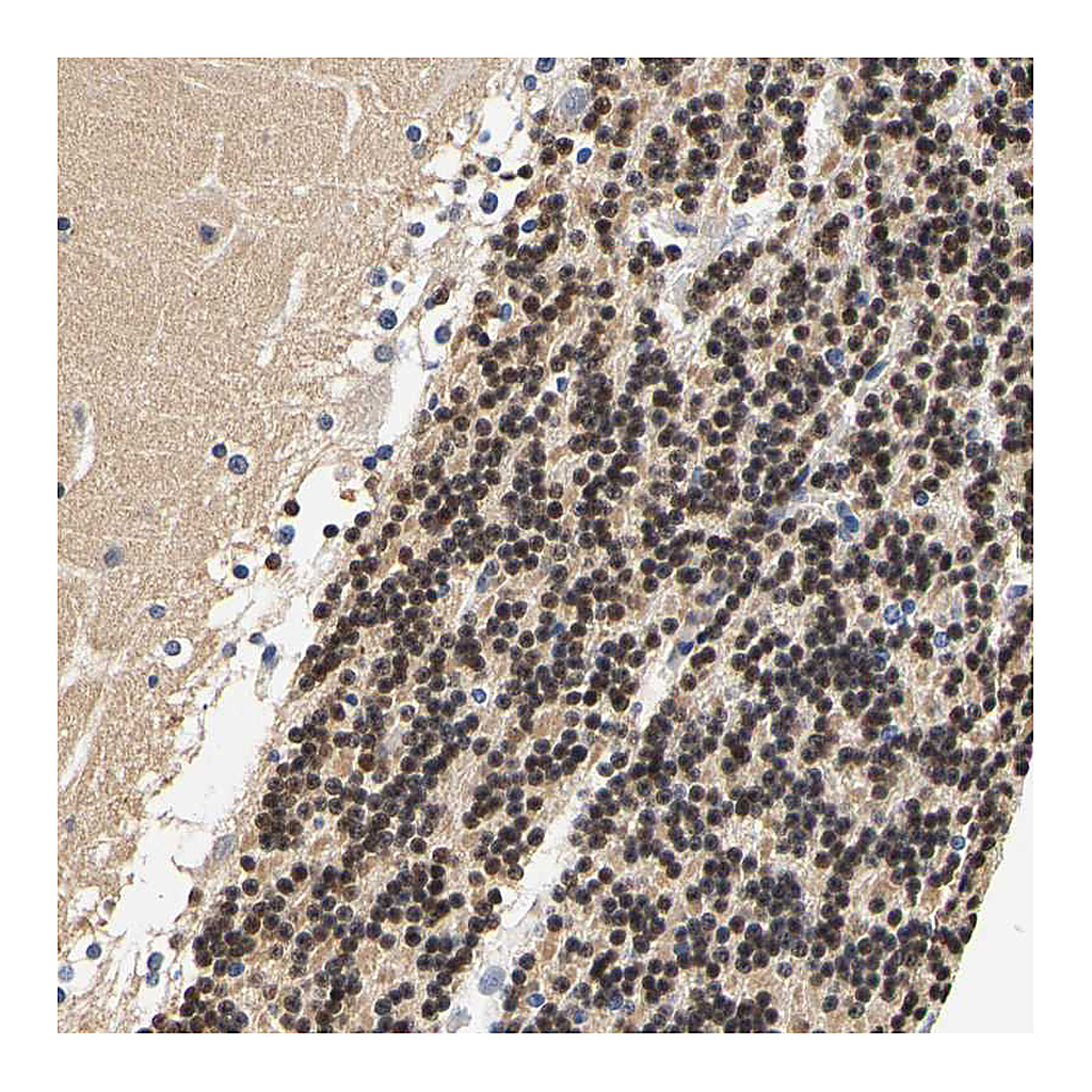 Atlas Antibodies Anti-CAMK4 Antibody
