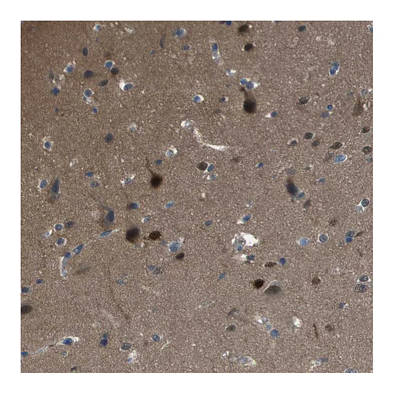 Atlas Antibodies Anti-CAMK4 Antibody