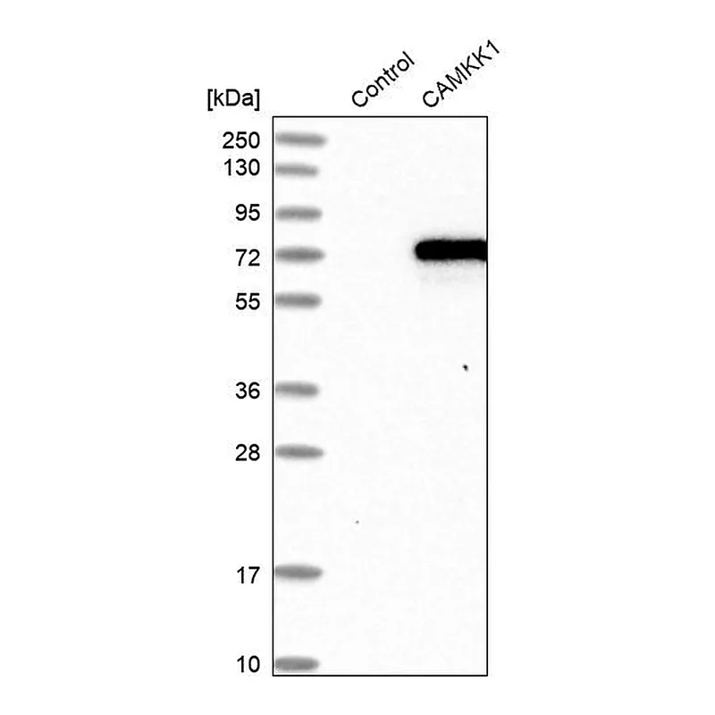 Atlas Antibodies Anti-CAMKK1 Antibody