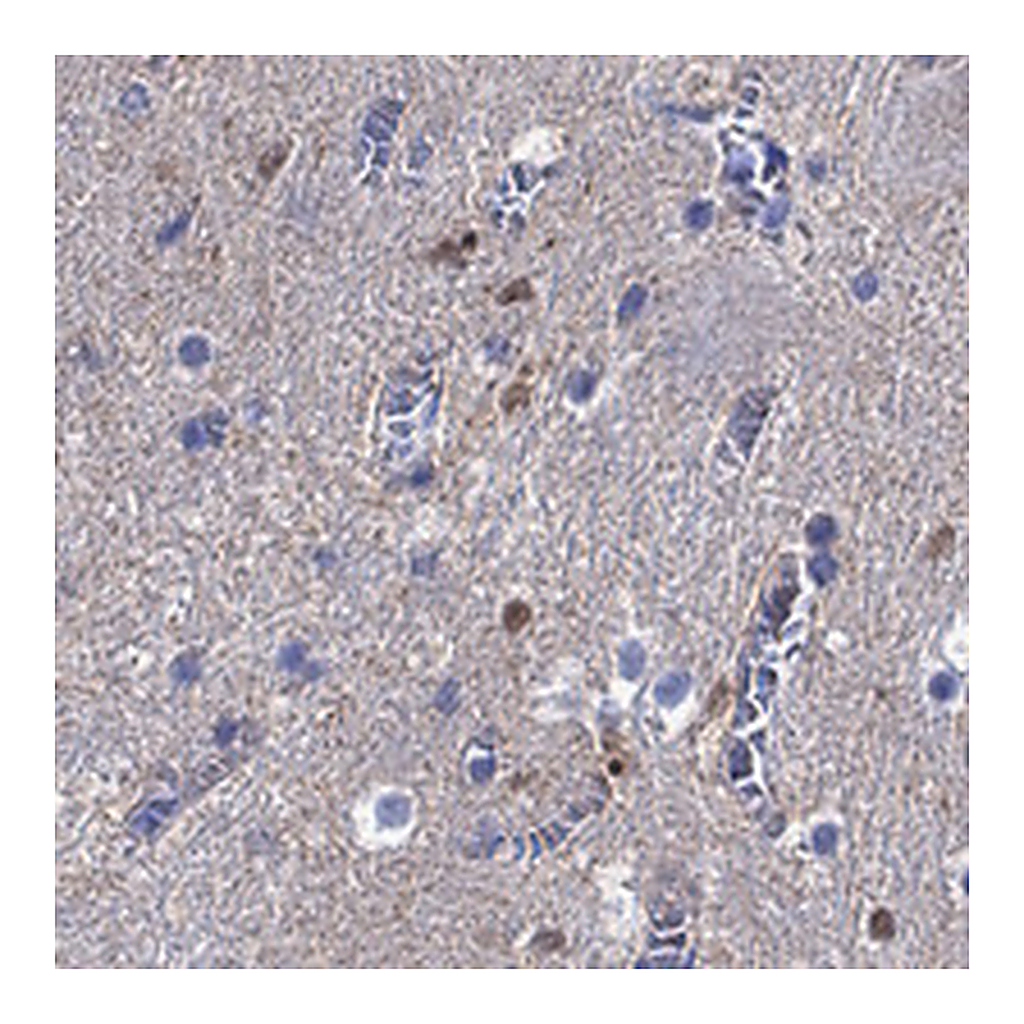 Atlas Antibodies Anti-CAMKK2 Antibody
