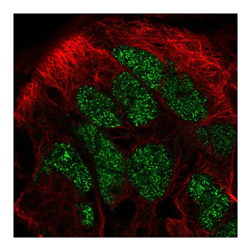 Atlas Antibodies Anti-CAMKMT Antibody