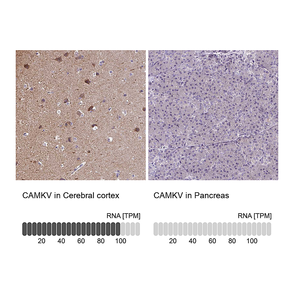 Atlas Antibodies Anti-CAMKV Antibody