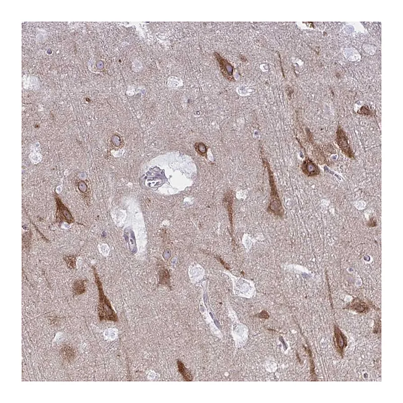 Atlas Antibodies Anti-CAMLG Antibody