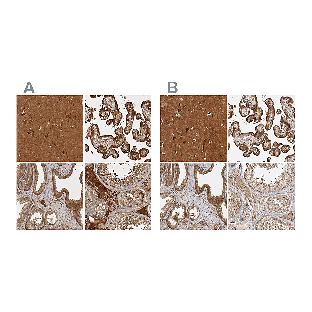 Atlas Antibodies Anti-CAMSAP2 Antibody
