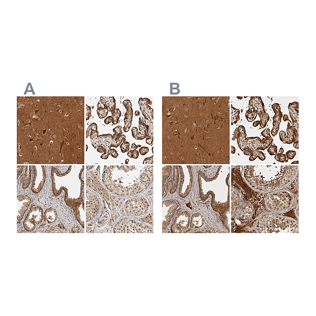 Atlas Antibodies Anti-CAMSAP2 Antibody