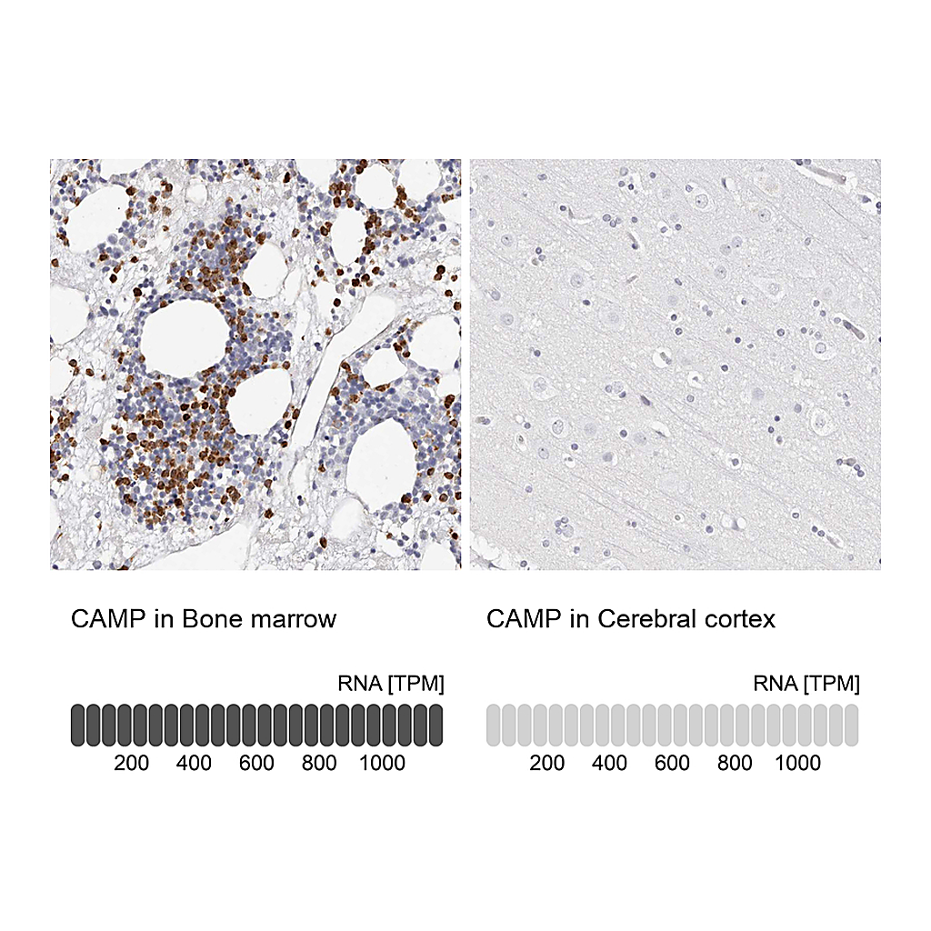 Atlas Antibodies Anti-CAMP Antibody