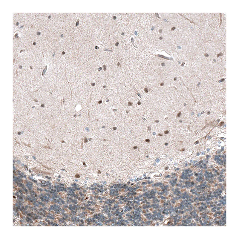 Atlas Antibodies Anti-CAMTA1 Antibody