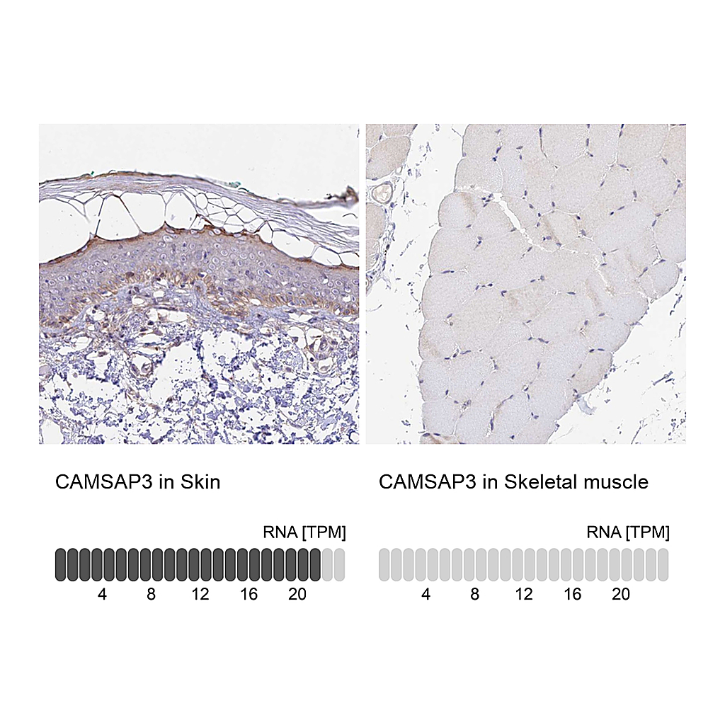 Atlas Antibodies Anti-CAMSAP3 Antibody