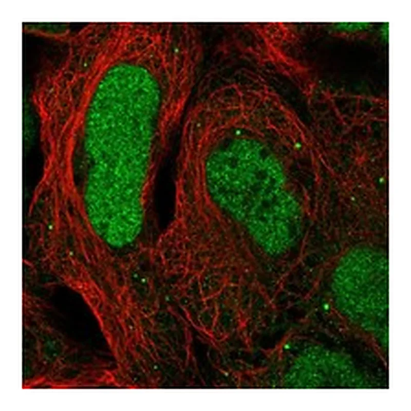 Atlas Antibodies Anti-CAMTA2 Antibody