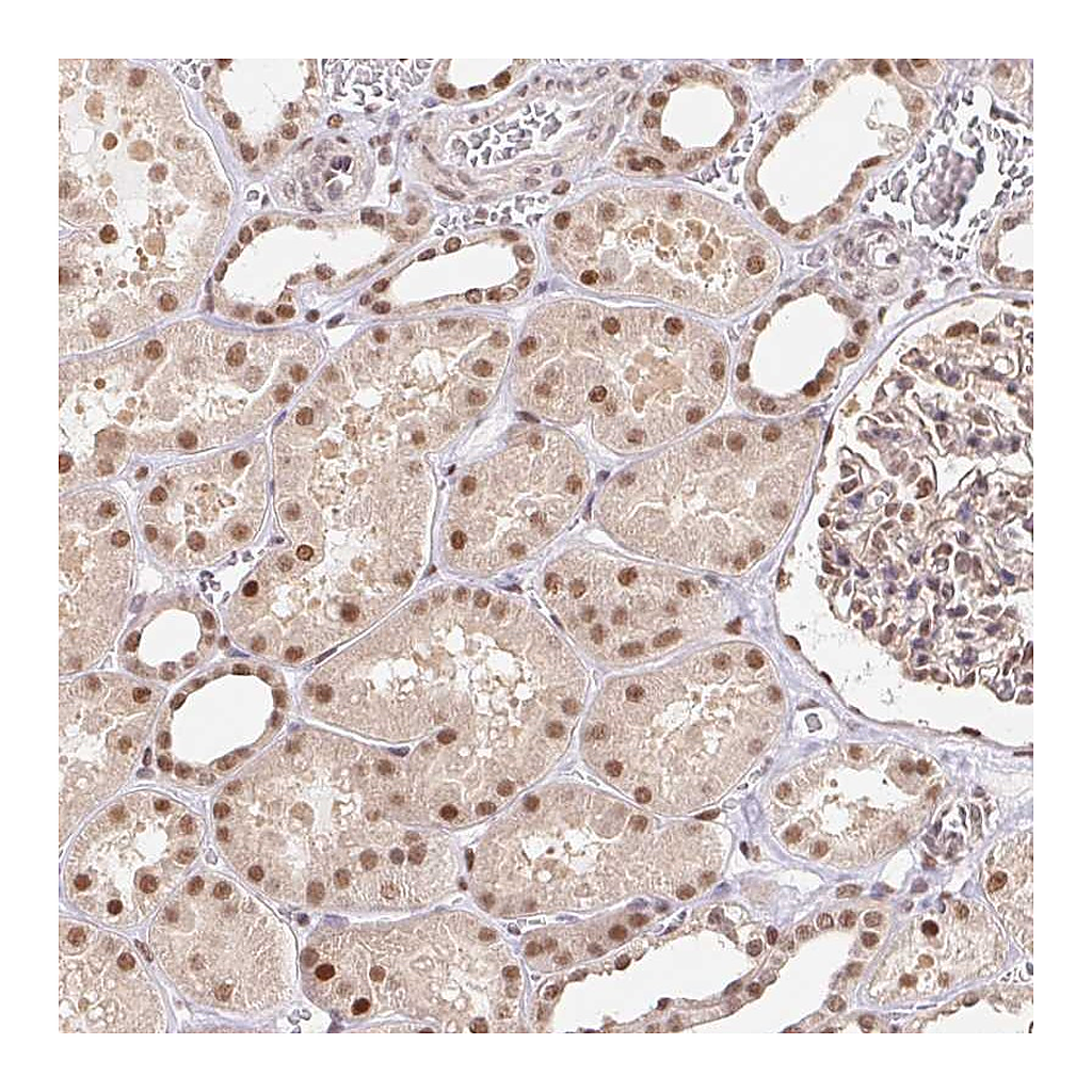 Atlas Antibodies Anti-CAND1 Antibody