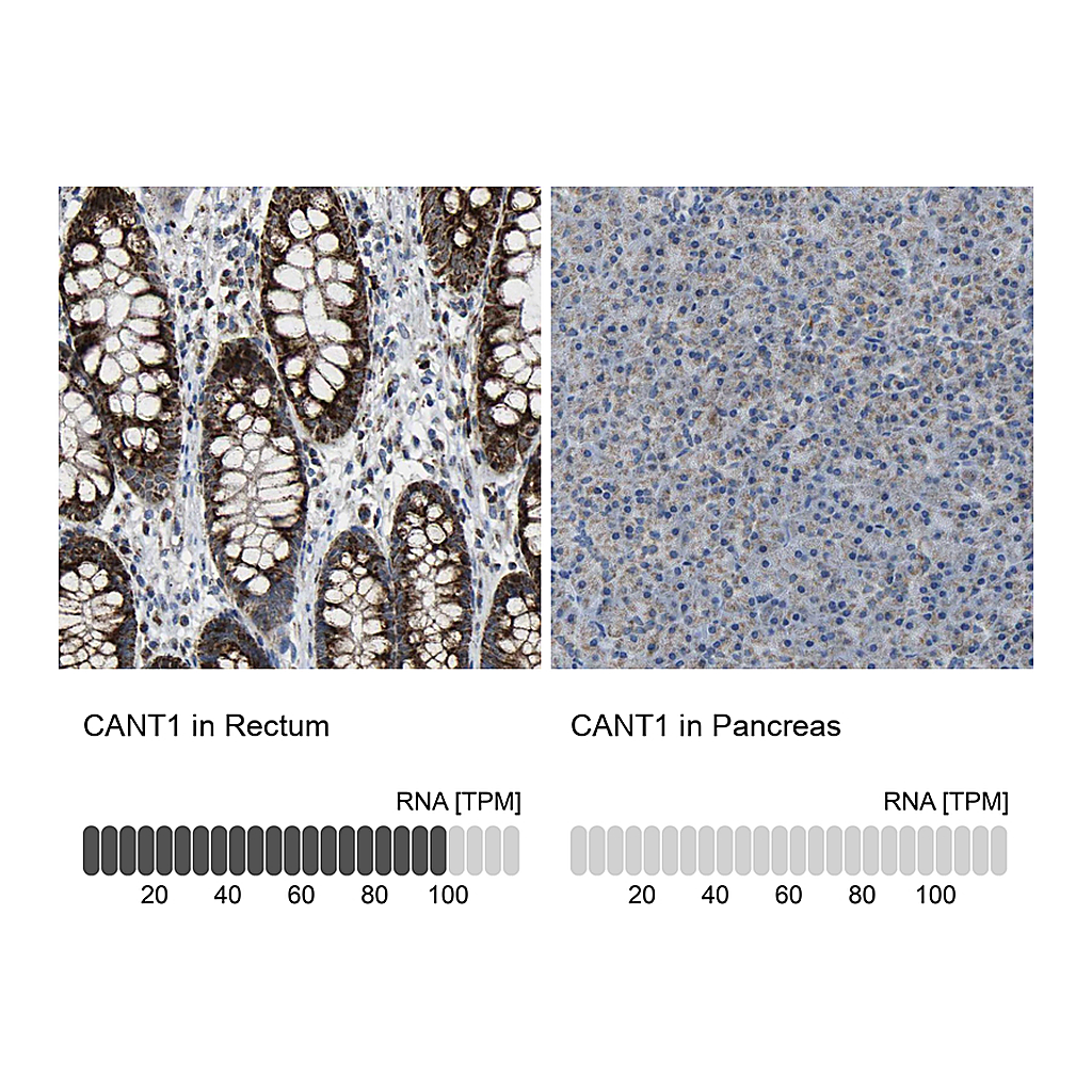 Atlas Antibodies Anti-CANT1 Antibody