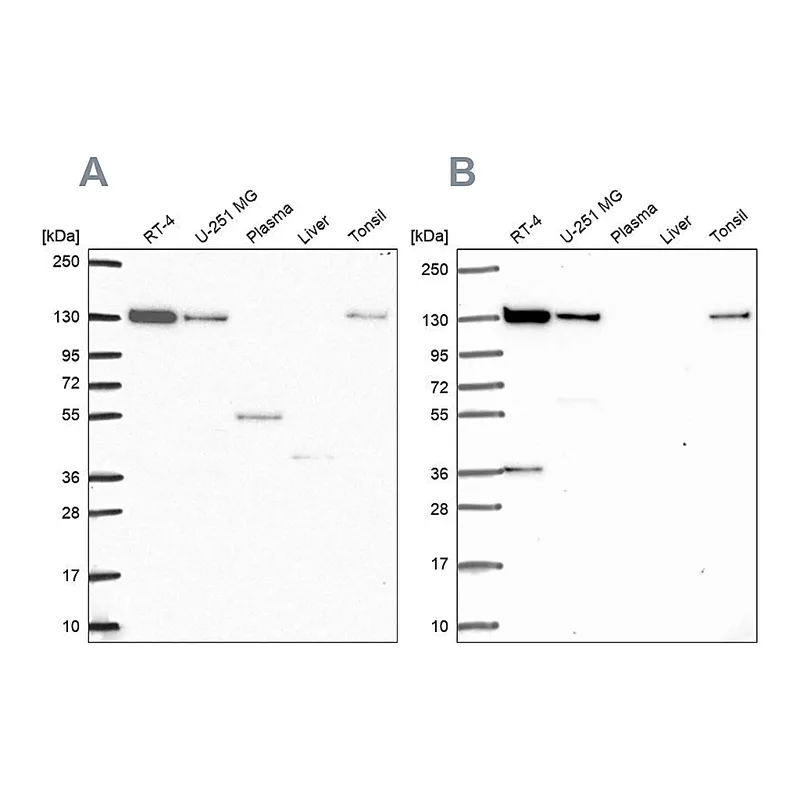 Atlas Antibodies Anti-CAND1 Antibody