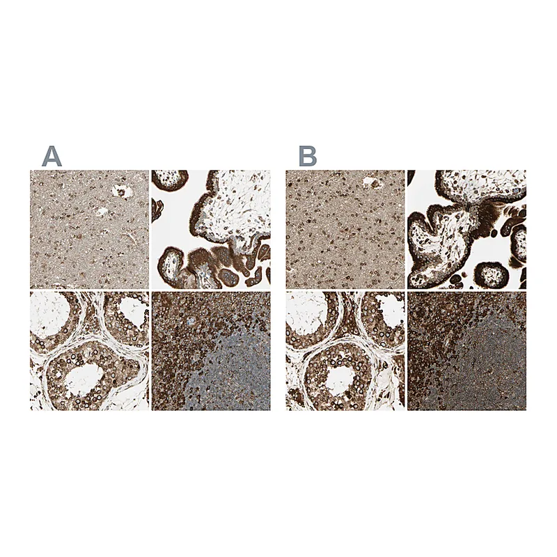 Atlas Antibodies Anti-CANX Antibody