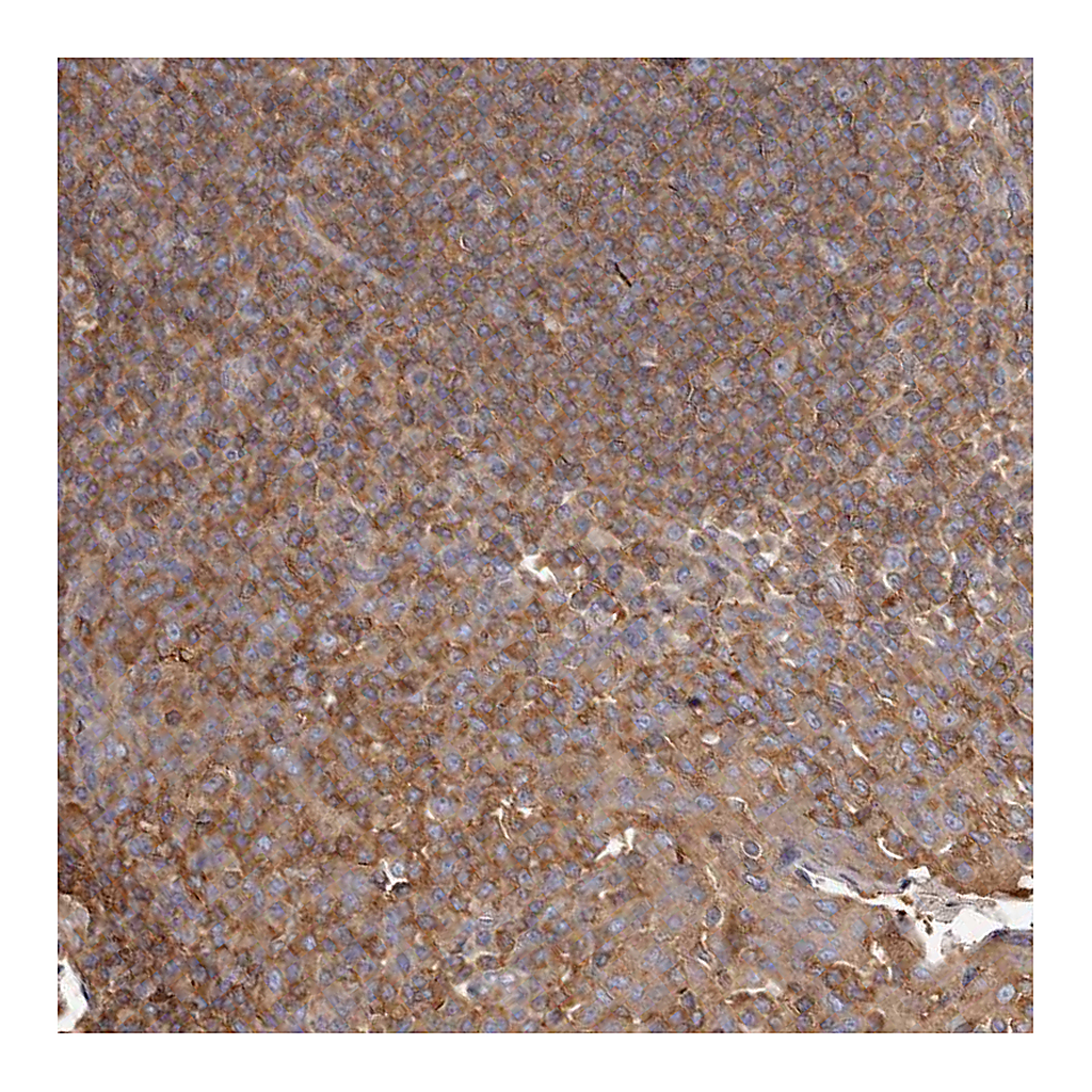 Atlas Antibodies Anti-CAP1 Antibody