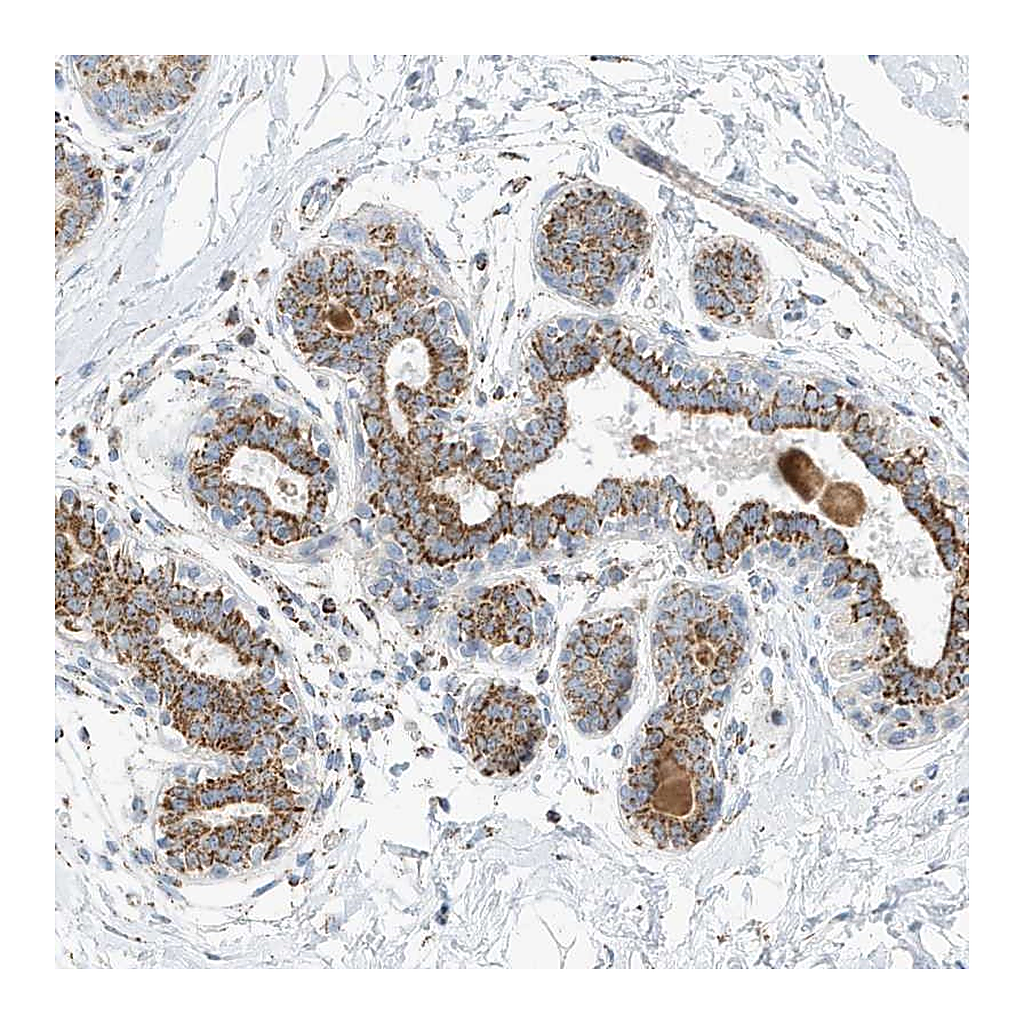 Atlas Antibodies Anti-CAPN13 Antibody
