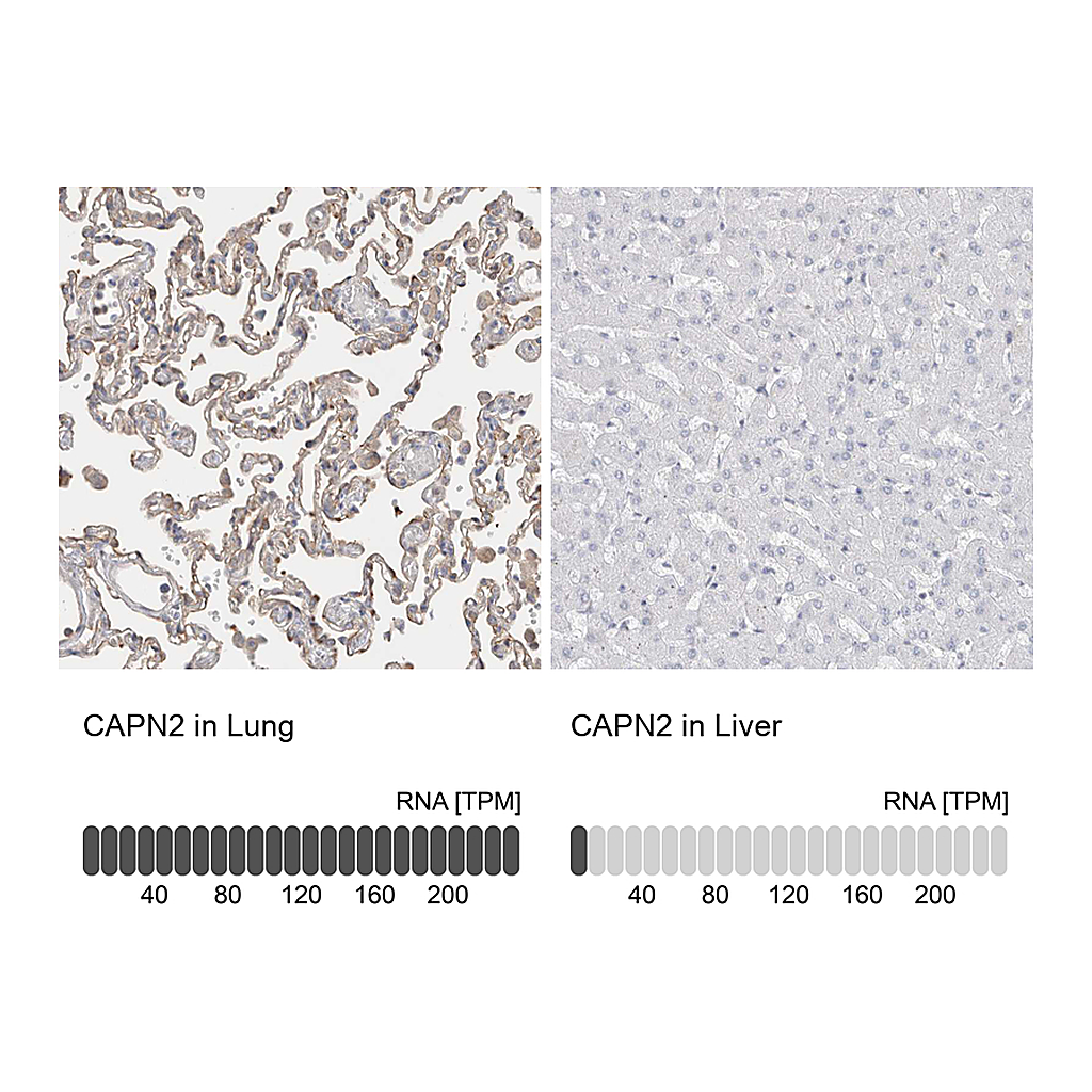 Atlas Antibodies Anti-CAPN2 Antibody
