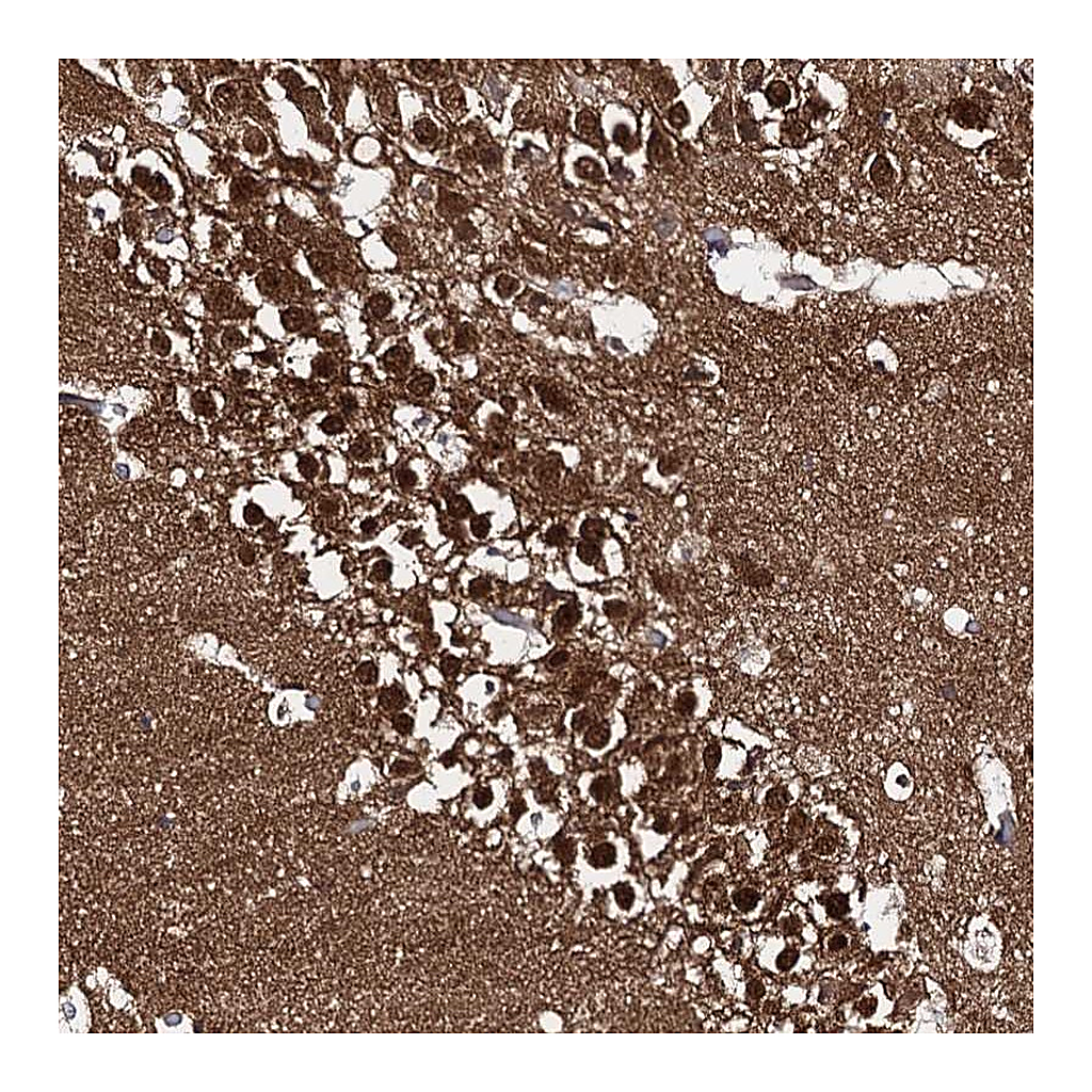 Atlas Antibodies Anti-CAPRIN2 Antibody