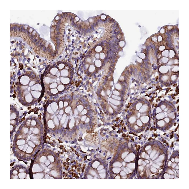 Atlas Antibodies Anti-CAPS2 Antibody