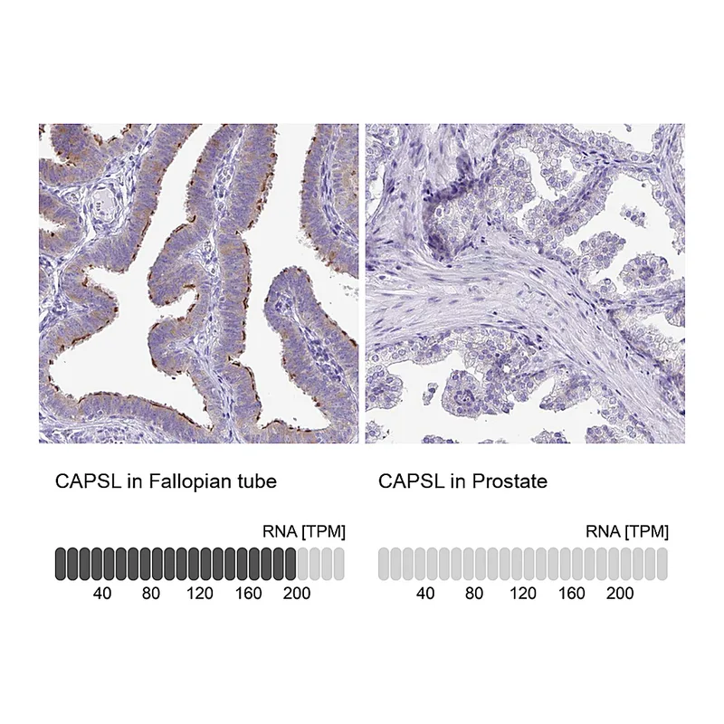 Atlas Antibodies Anti-CAPSL Antibody