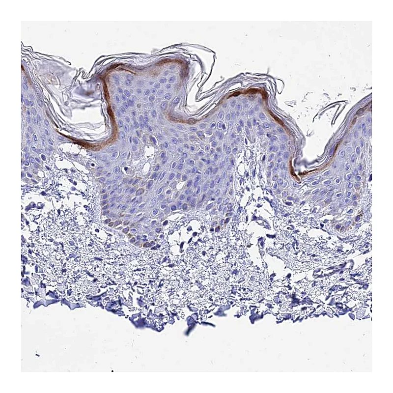 Atlas Antibodies Anti-CARD18 Antibody