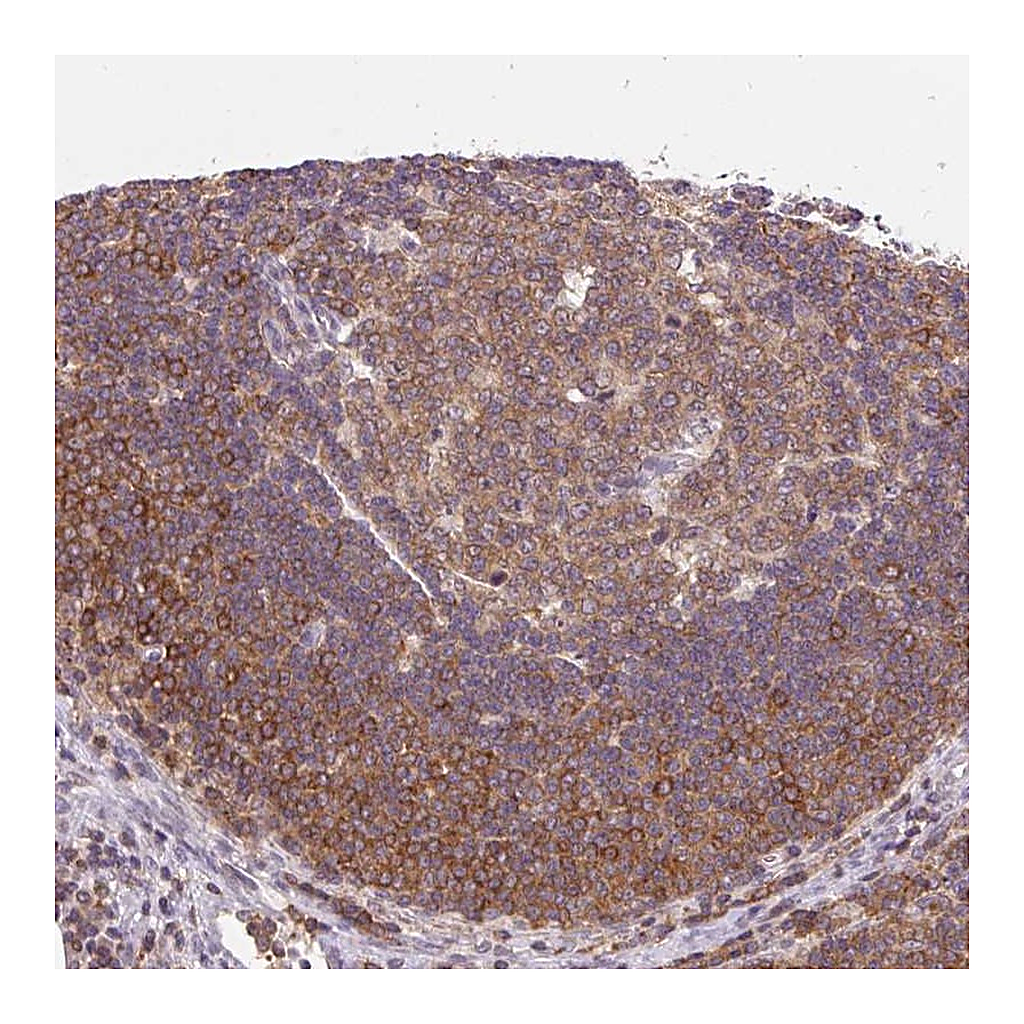 Atlas Antibodies Anti-CARD11 Antibody