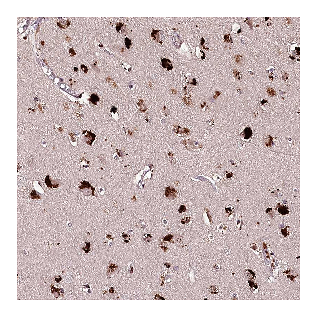 Atlas Antibodies Anti-CARD19 Antibody