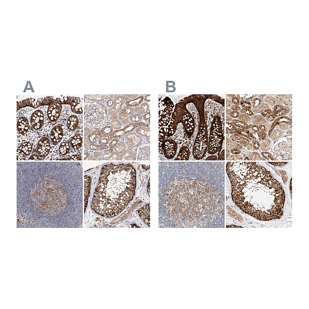 Atlas Antibodies Anti-CARMIL1 Antibody