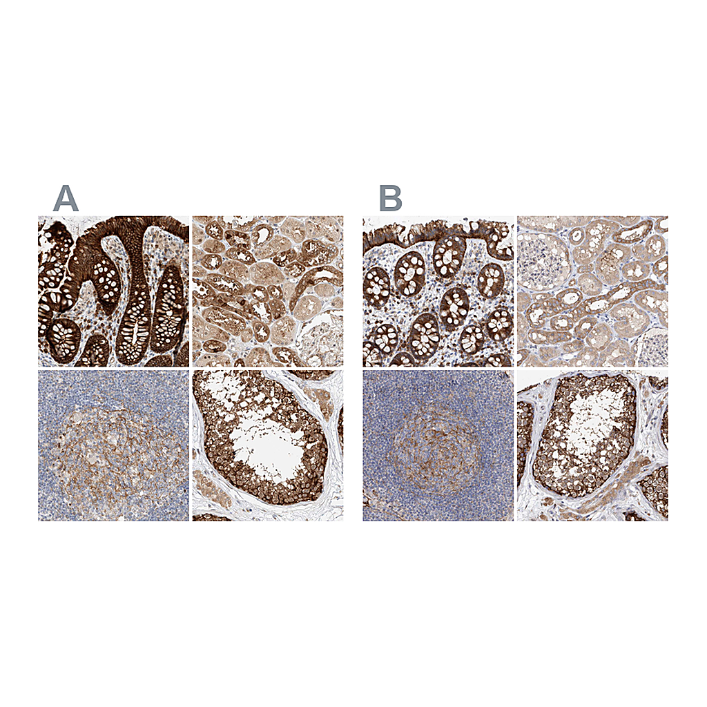 Atlas Antibodies Anti-CARMIL1 Antibody