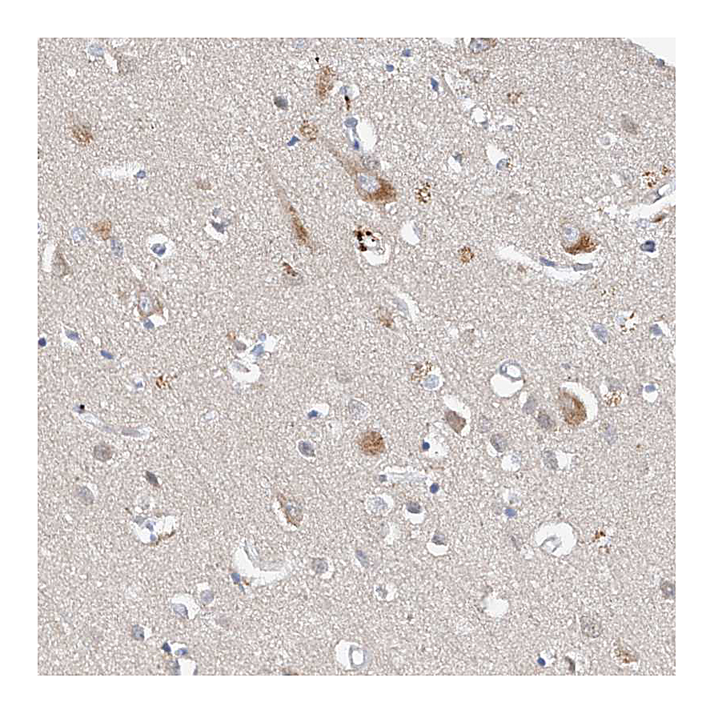 Atlas Antibodies Anti-CARMIL3 Antibody