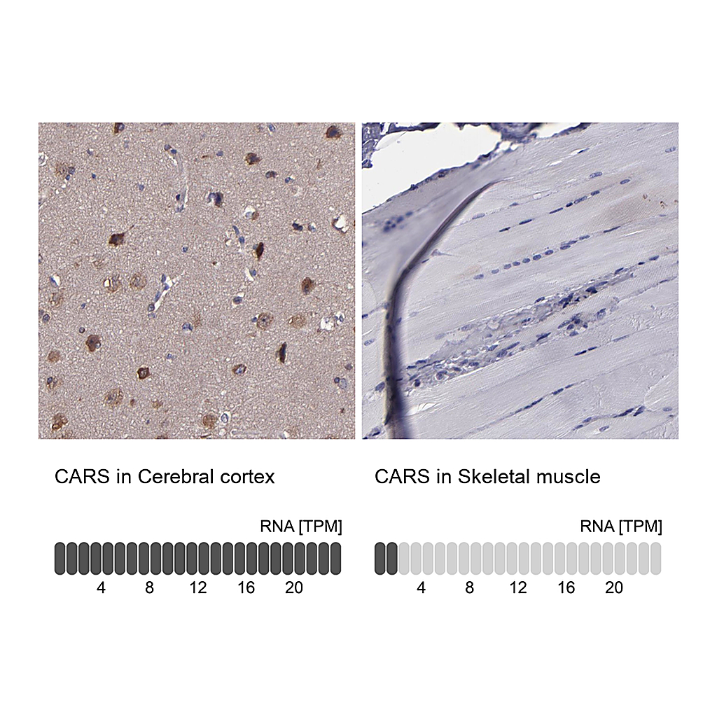 Atlas Antibodies Anti-CARS Antibody