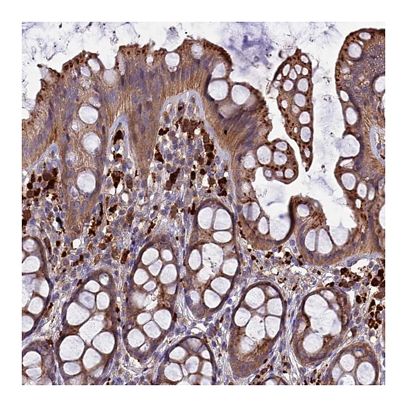 Atlas Antibodies Anti-CARMIL2 Antibody