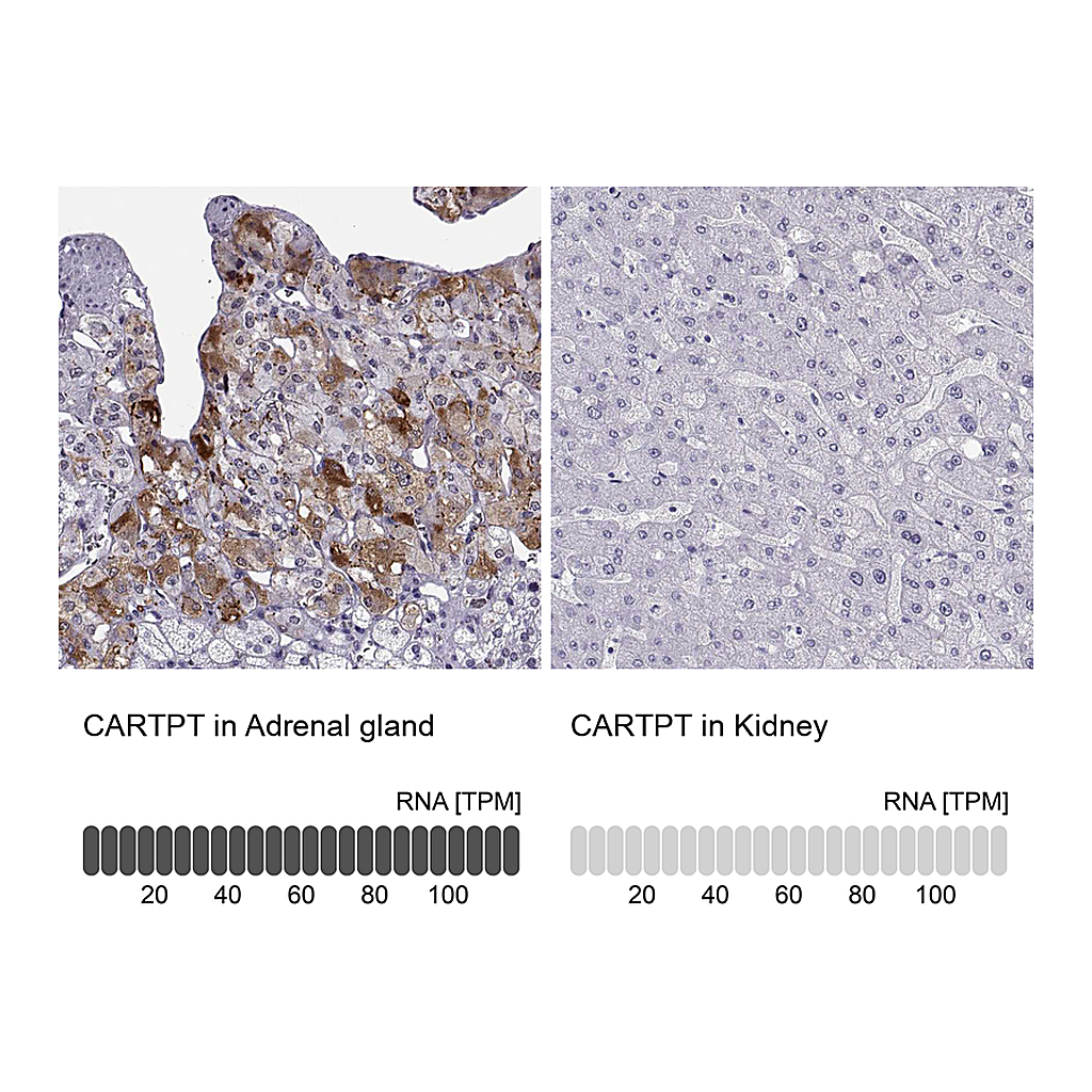 Atlas Antibodies Anti-CARTPT Antibody