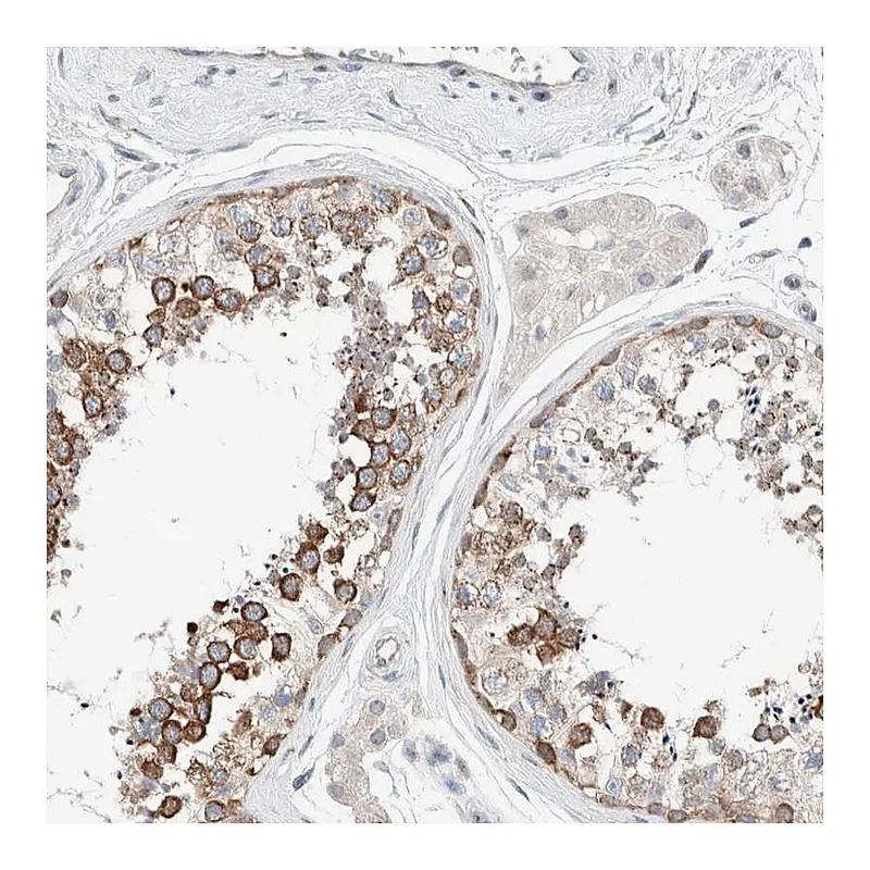 Atlas Antibodies Anti-CASC3 Antibody