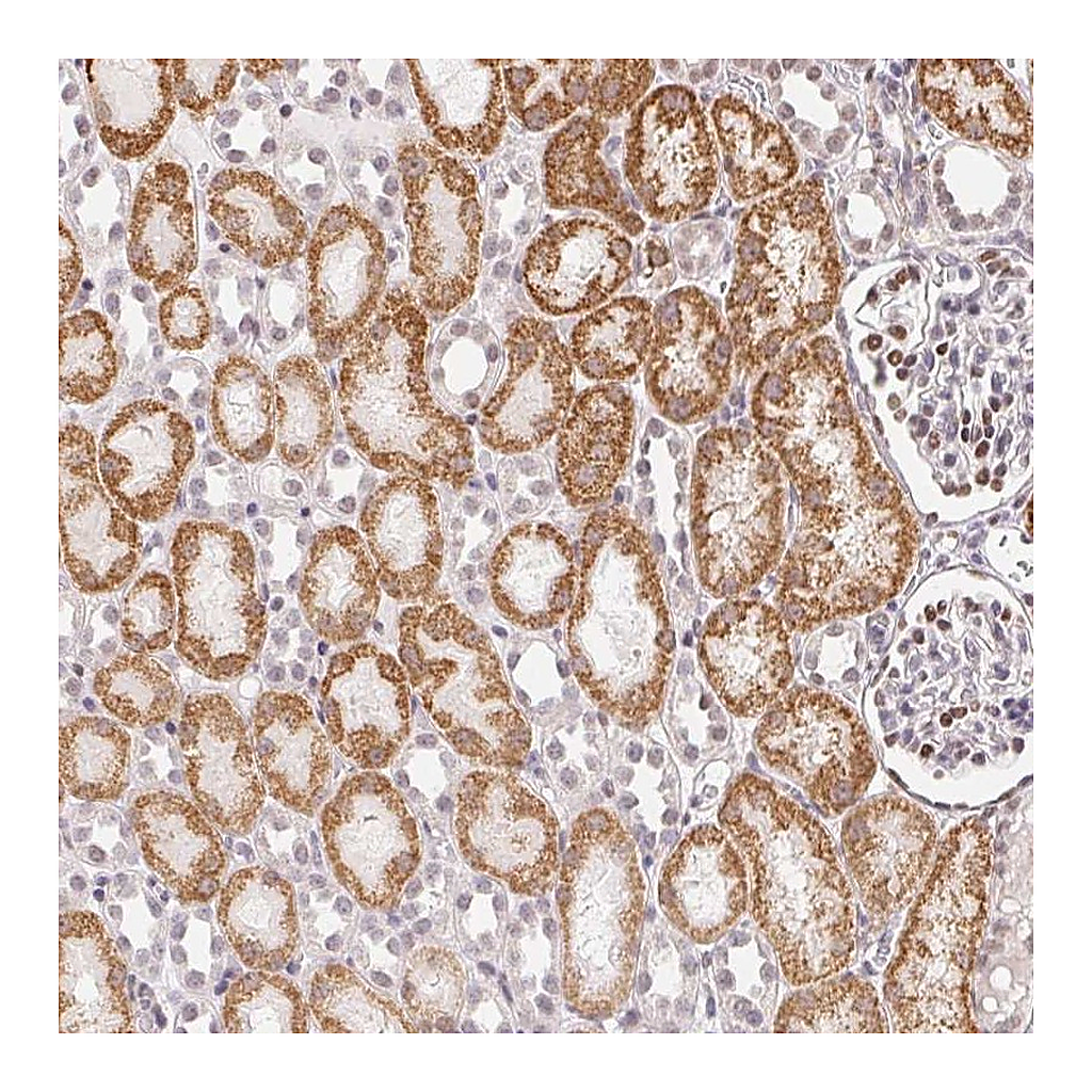 Atlas Antibodies Anti-CASC10 Antibody