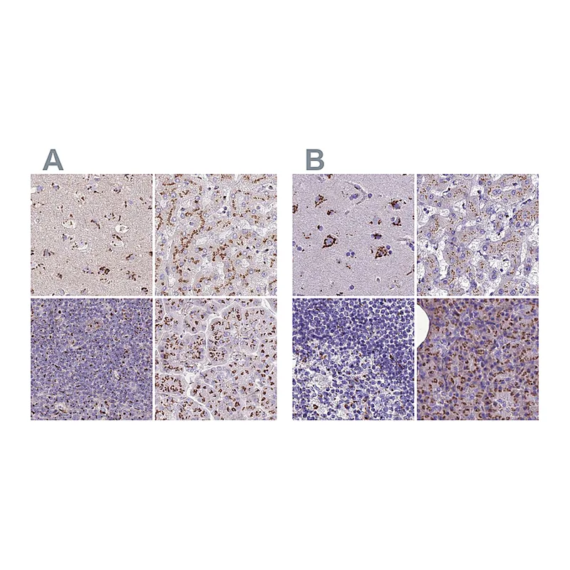 Atlas Antibodies Anti-CASC4 Antibody
