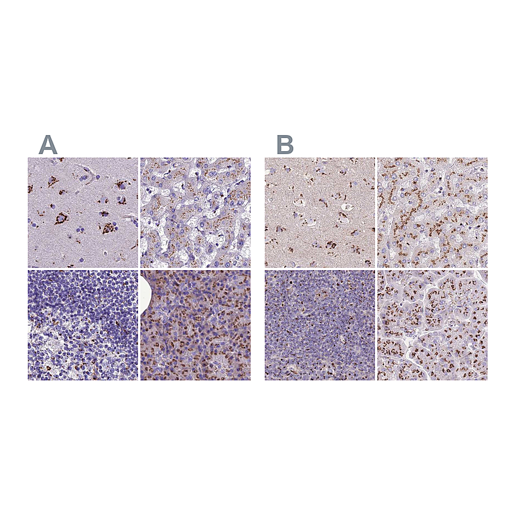 Atlas Antibodies Anti-CASC4 Antibody