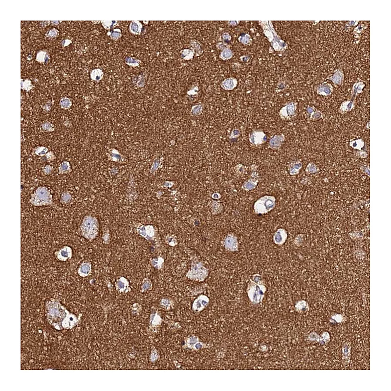 Atlas Antibodies Anti-CASD1 Antibody