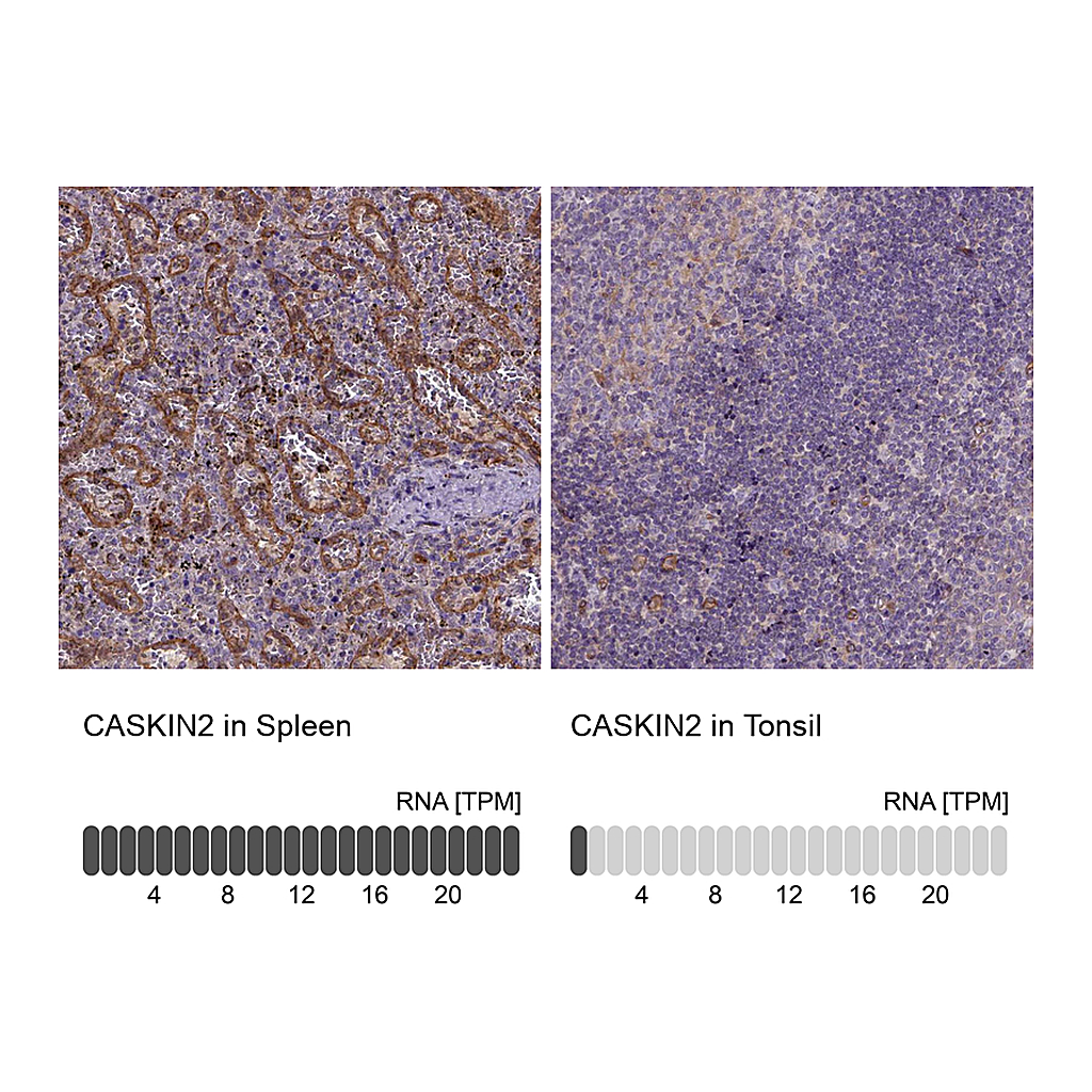 Atlas Antibodies Anti-CASKIN2 Antibody