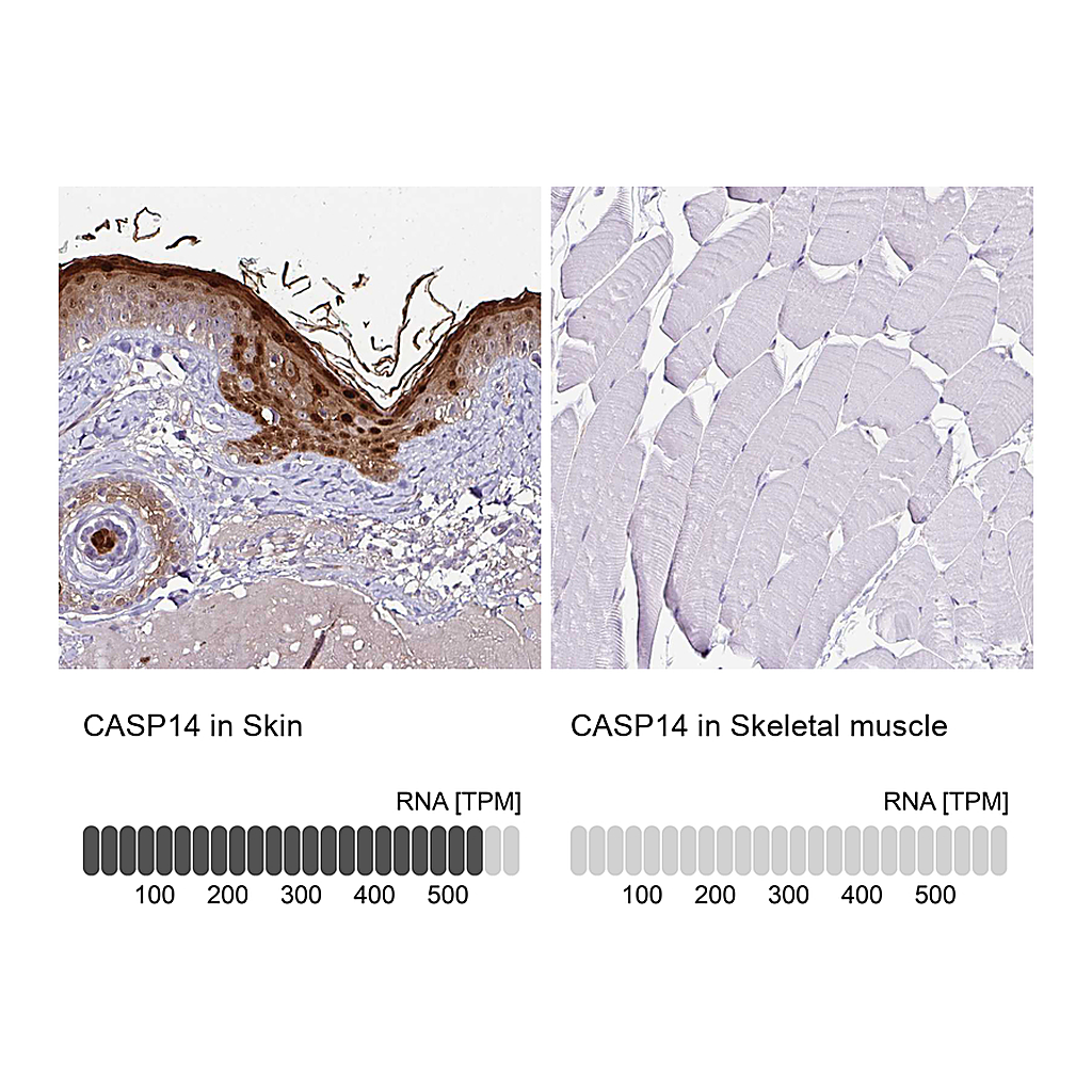 Atlas Antibodies Anti-CASP14 Antibody