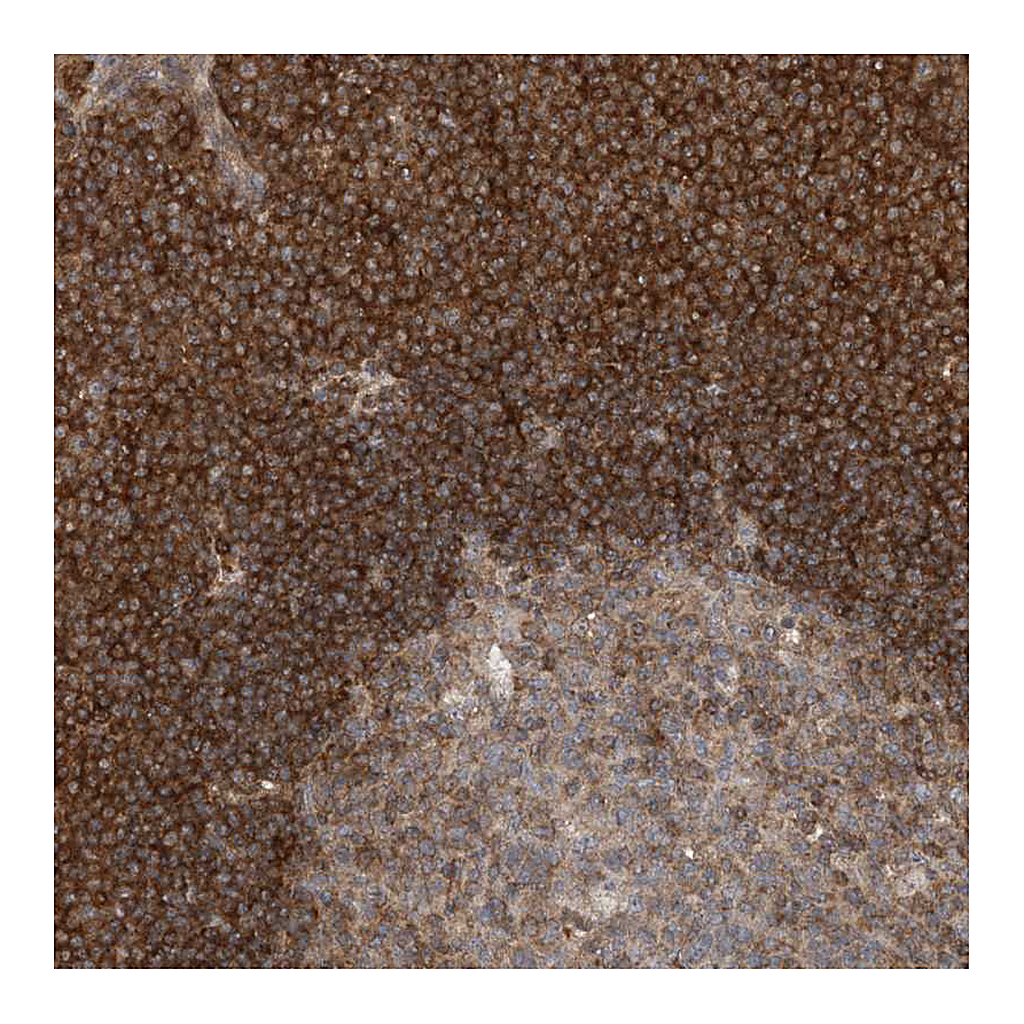 Atlas Antibodies Anti-CASP4 Antibody