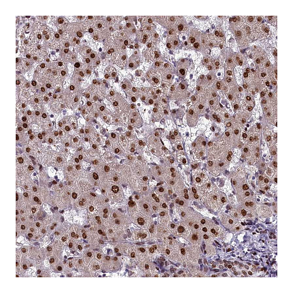 Atlas Antibodies Anti-CASP5 Antibody