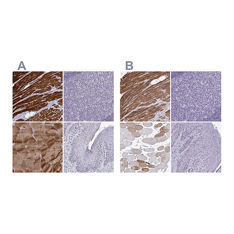 Atlas Antibodies Anti-CASQ2 Antibody