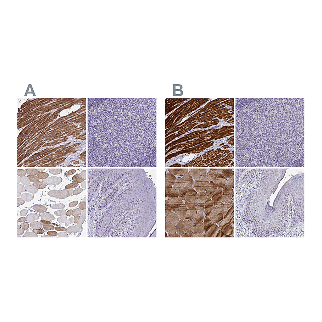 Atlas Antibodies Anti-CASQ2 Antibody