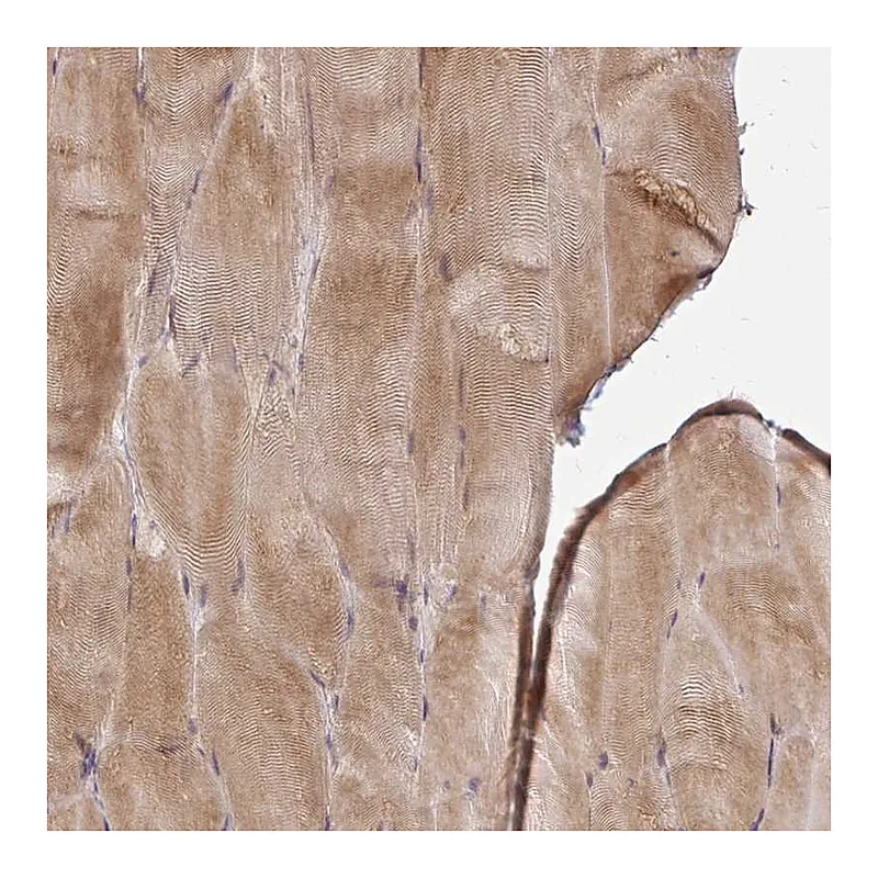 Atlas Antibodies Anti-CAST Antibody